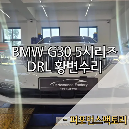 BMW 황변 G바디 고질병 교체 대신 수리로 비용 세이브하세요!