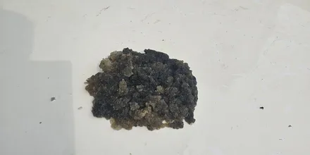 인천 루프스킨 제거 깔끔하게 하고 재시공 / 인천 논현동