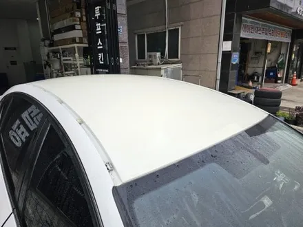 인천 루프스킨 제거 깔끔하게 하고 재시공 / 인천 논현동