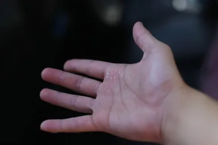 춘천썬팅 혹시 내 차에도 이런 현상이 있다면 빨리 재시공 받으세요!