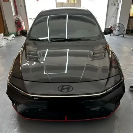 [HYUNDAI]현대 2024 아반떼N 리얼카본 본넷 2종 출시! 신제품은 가장 빠르게 전달하는 낭만무역! / 충청 금산