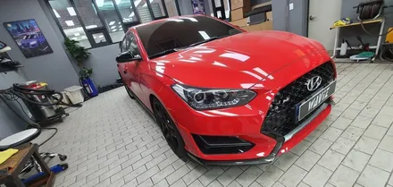 송파 HYUNDAI VELOSTER N - 벨로스터N에 측후방감지기 BSM 센서와 전방감지기 장착! / 잠실, 삼전, 송파