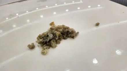 천안 루프스킨 제거  아산 랩핑 제거 K3 변색되고 갈라짐 현상 있어도 제거가 가능해요 / 충남 아산