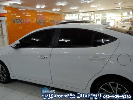 인천 신차