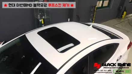 [울산루프스킨제거][울산랩핑] 현대 아반떼MD 루프스킨 제거 시공기 - 블랙샤인 울산점 / 울산광역시 남구