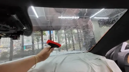 후퍼옵틱 프나세 농도 가격 백탁현상 없는 곳 / 서울 성북구 안암동5가